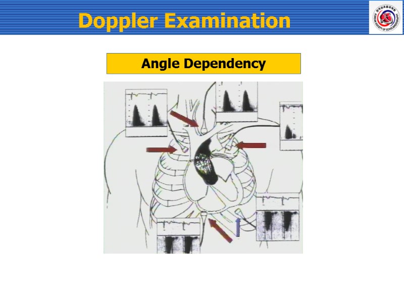 Angle Dependency Doppler Examination